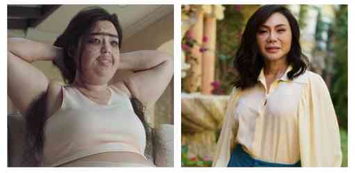 Belo Medical Group apologizes over 'insensitive' pandemic ad