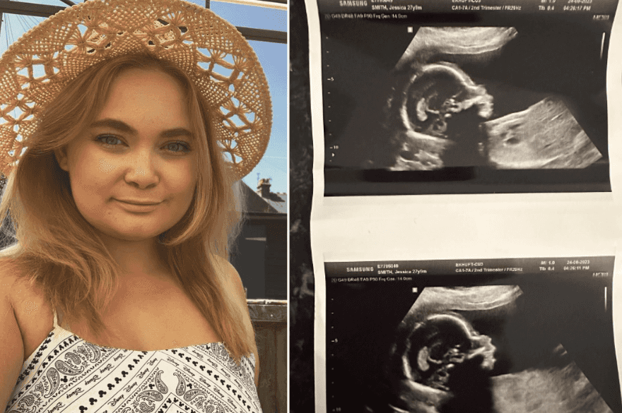 ‘Teletubbies’ Sun Baby star Jess Smith is going to be a mom