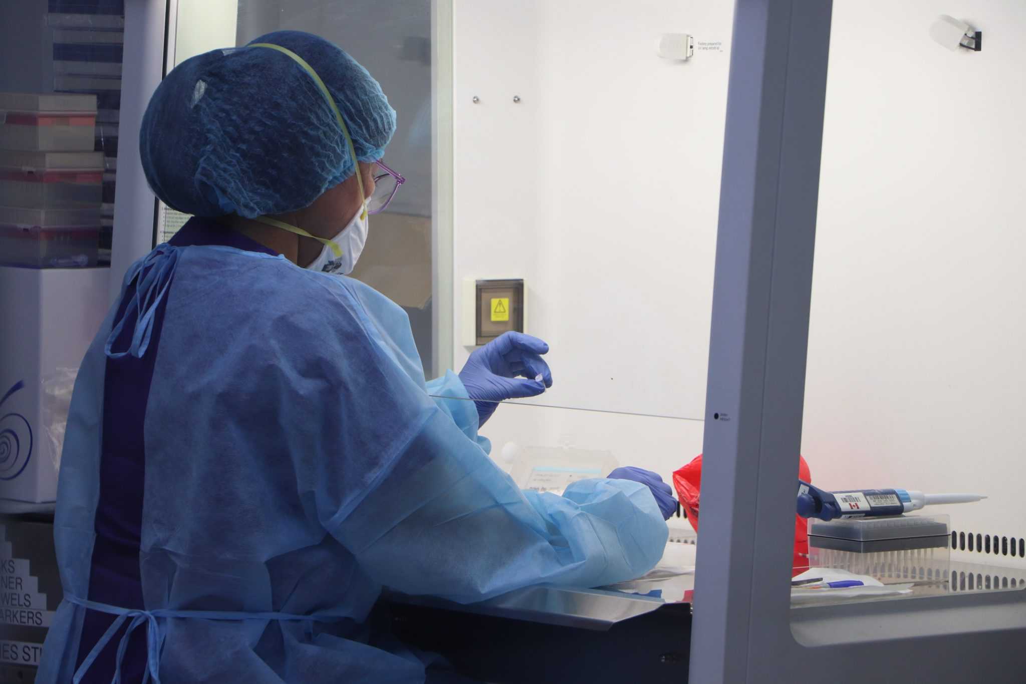 RITM now equipped for real time PCR test for monkeypox