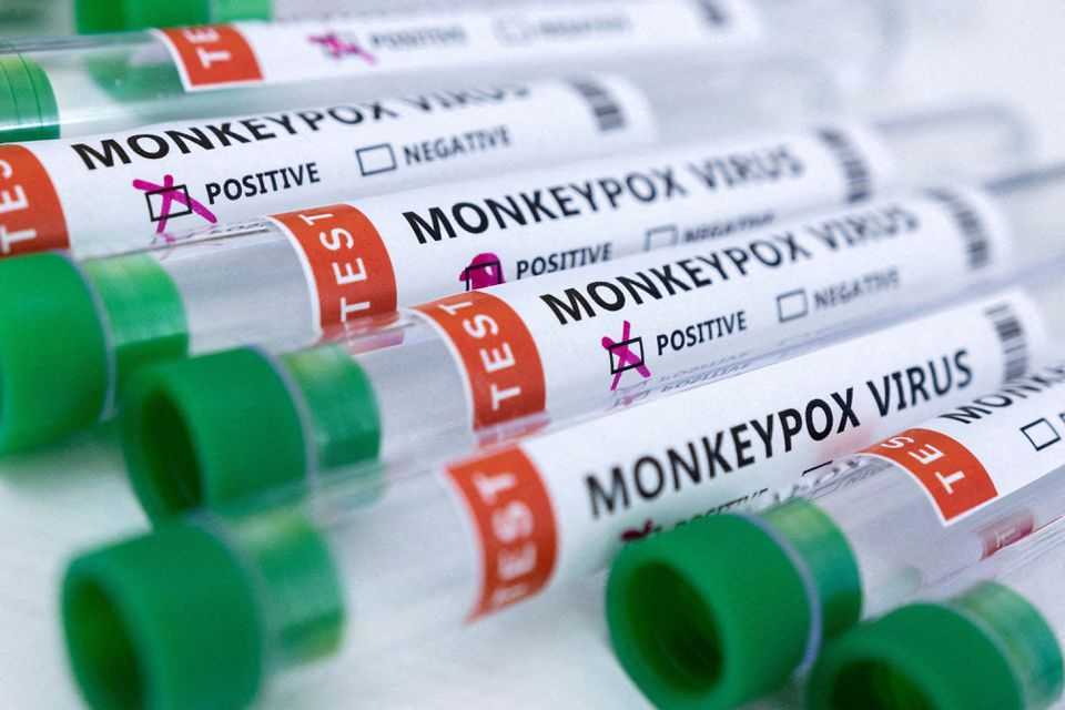 Expert clarifies: Monkeypox not only infect the LGBTQ community