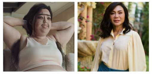 Belo Medical Group apologizes over 'insensitive' pandemic ad