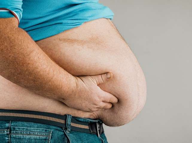 Health expert expresses alarm over rising obesity in PH