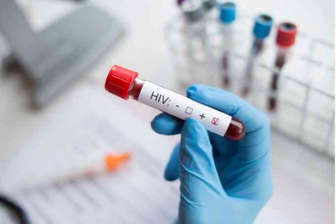 More Filipino teens diagnosed with HIV in January — DOH