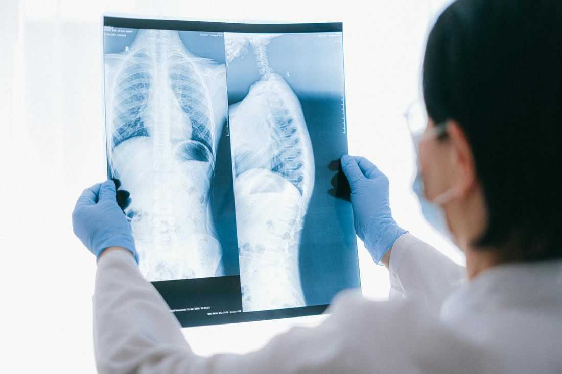 Health expert flags rising pneumonia cases linked to 'super flu'