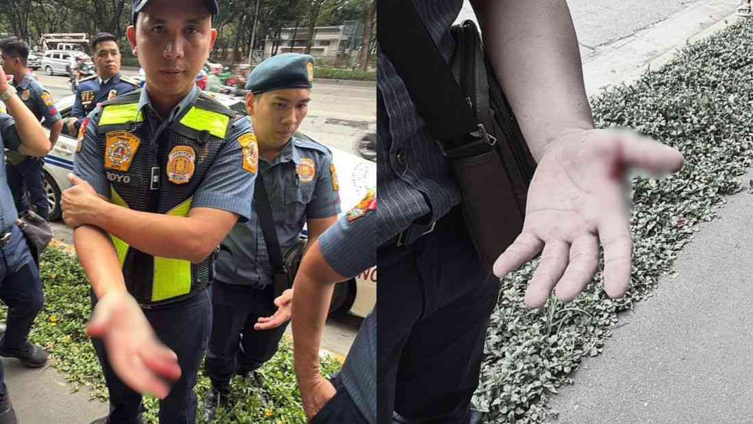 Police officers hurt during rally outside DAR in Quezon City – QCPD