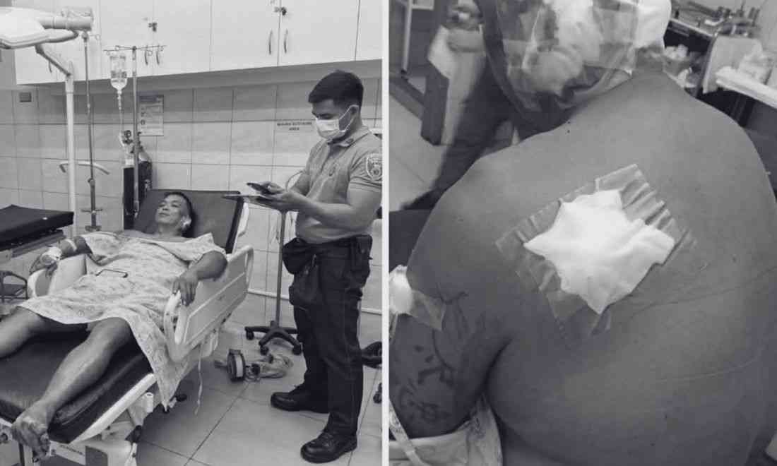 Truck driver stabbed with ice pick while trying to stop co-worker's rampage in Marikina