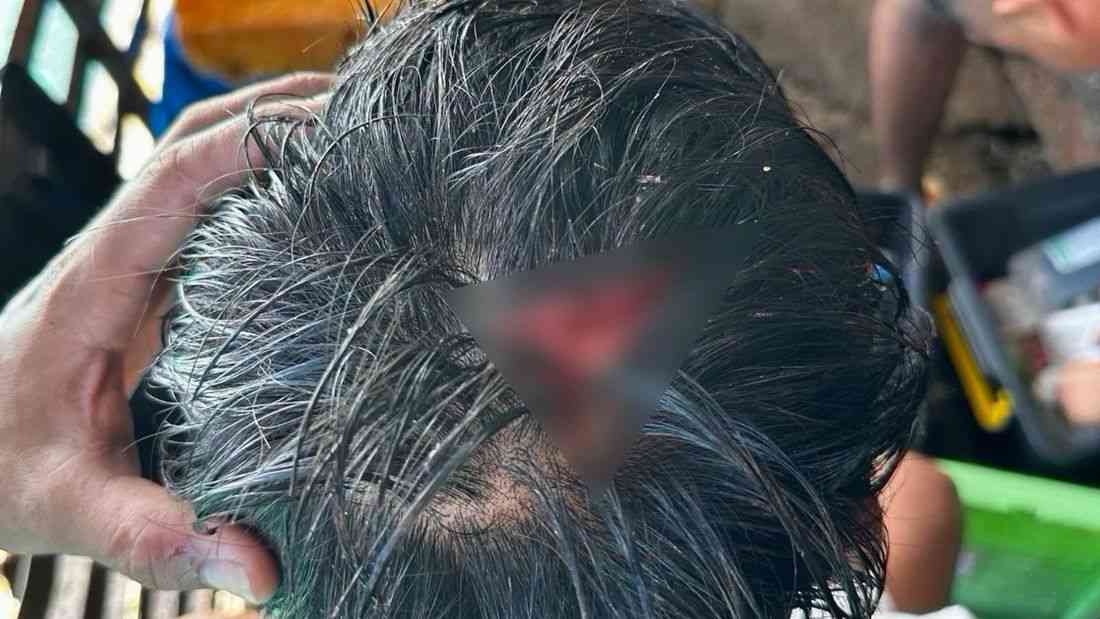 PH Navy personnel injured after being hit by China Coast Guard in Ayungin Shoal — AFP