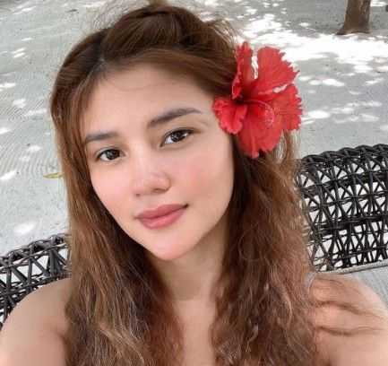 Ana Jalandoni shares bruised photo amid assault allegations vs Kit Thompson