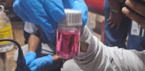 Baguio City launches probe on outbreak of gastroenteritis cases