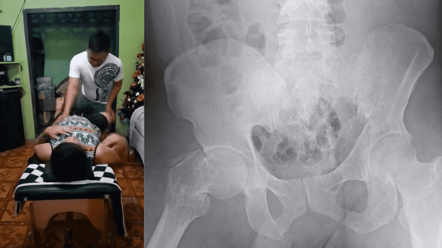 Content creator dies of injuries from chiropractic session