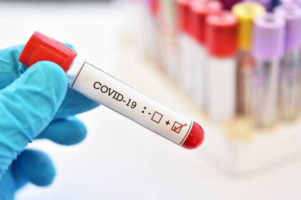 Evacuee in Daraga, Albay tested positive in COVID-19