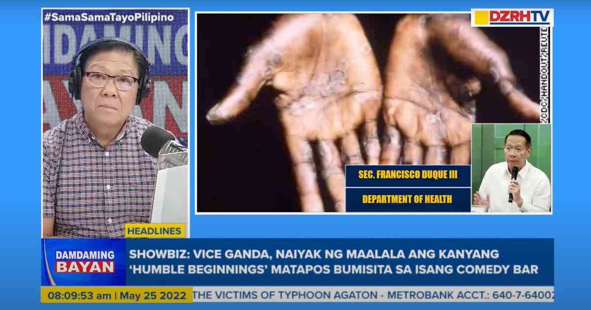 DOH orders tighter border control amid threat of monkeypox