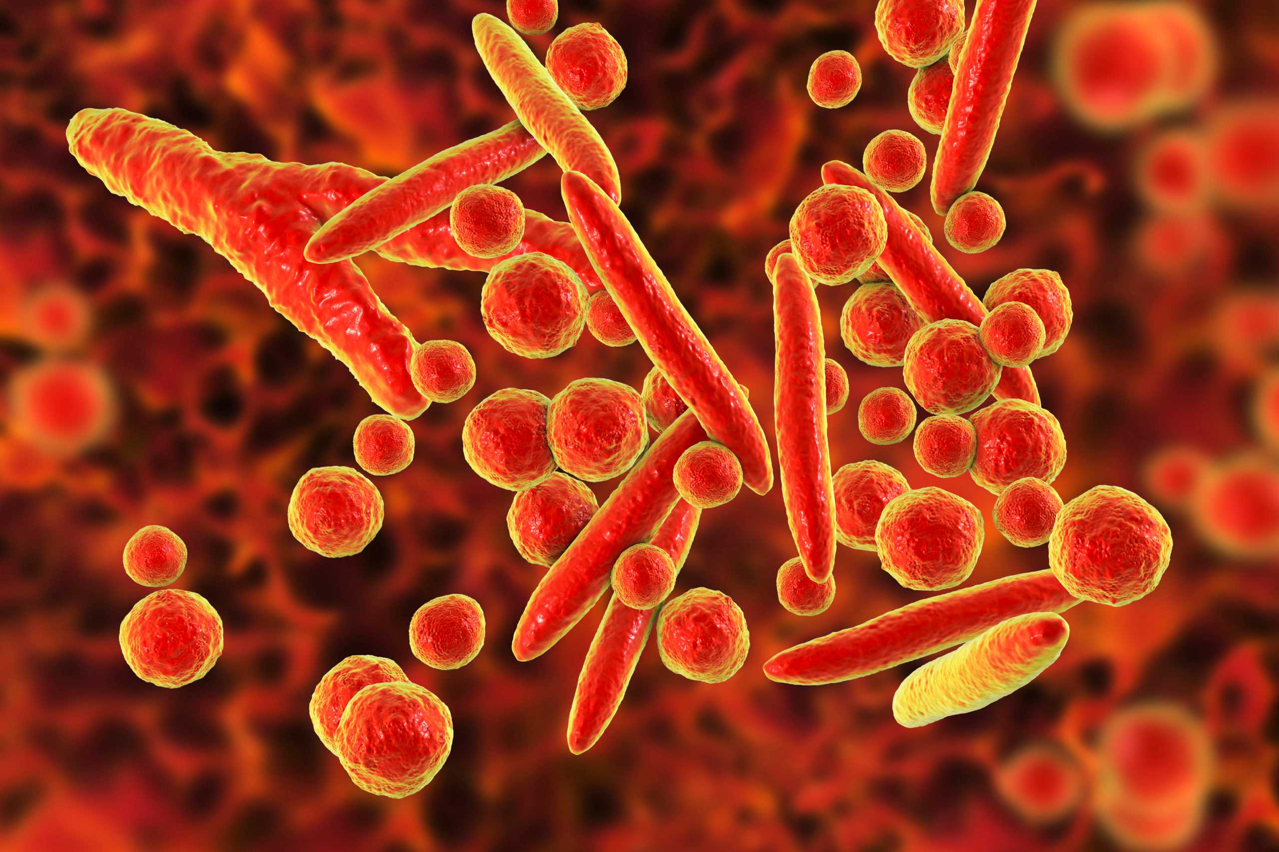 DOH reports 4 confirmed cases of ‘walking pneumonia’