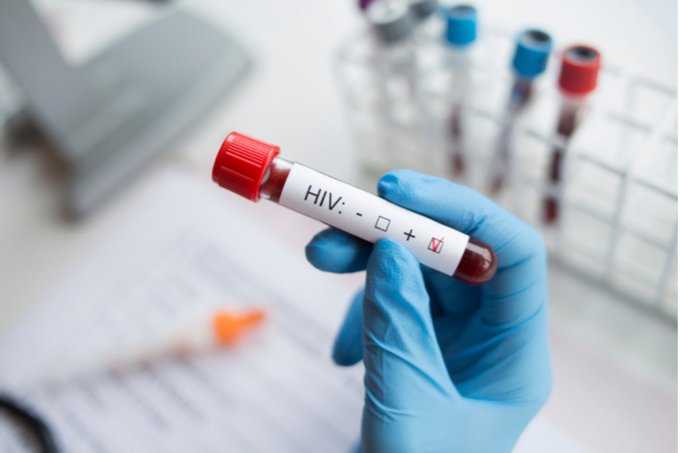 Gatchalian wants Senate to probe on rising HIV cases among youth