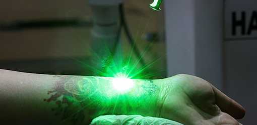 Indonesian Muslims sign up for tattoo removal 'to repent' during Ramadan