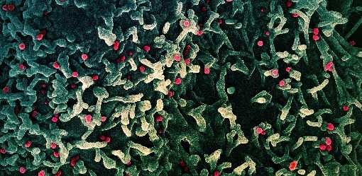 One case of clade 2 mpox detected in Pakistan, new strain not detected