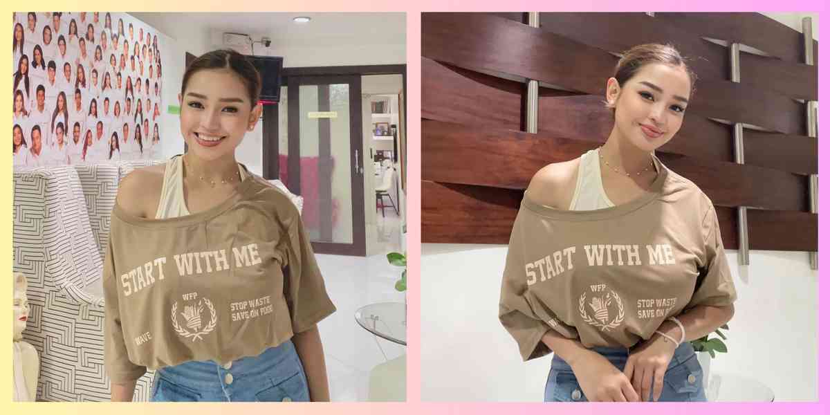 LOOK: Xyriel Manabat reveals stunning transformation after rhinoplasty